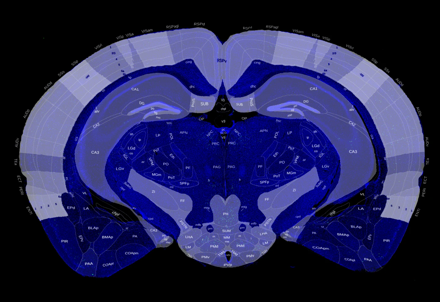 brain_slice_mapped