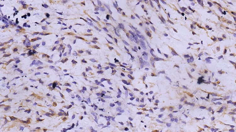 IHC 染色