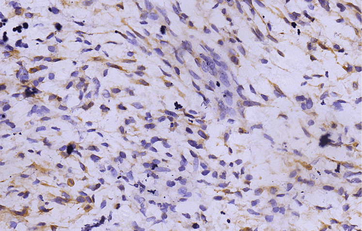 IHC 染色
